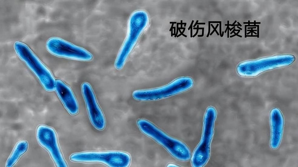 詳細(xì)介紹幾種常見(jiàn)的爛身病病原體，“爛身病”是一種由多種常見(jiàn)的爛身病原體引起的疾病