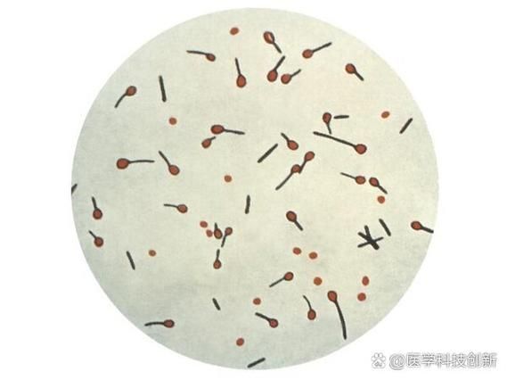 詳細(xì)介紹幾種常見(jiàn)的爛身病病原體，“爛身病”是一種由多種常見(jiàn)的爛身病原體引起的疾病