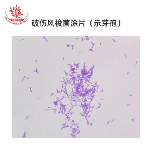 詳細(xì)介紹幾種常見(jiàn)的爛身病病原體，“爛身病”是一種由多種常見(jiàn)的爛身病原體引起的疾病