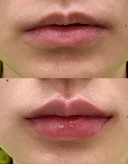 如何預(yù)防龍魚嘴角長(zhǎng)肉疙瘩？，如何預(yù)防龍魚嘴角長(zhǎng)肉疙瘩調(diào)用工具arxiv論文助手