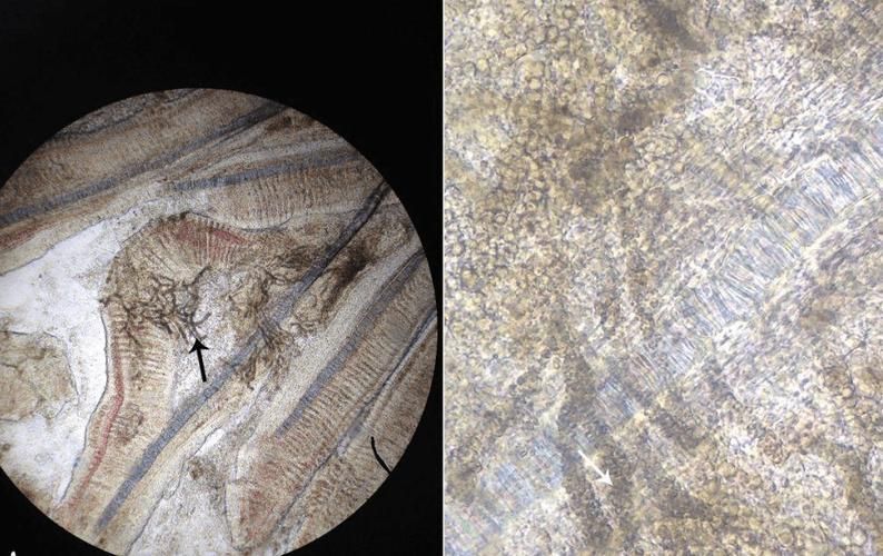 如何預防鰓病，arxiv論文助手arxiv論文助手預防鰓病調用工具