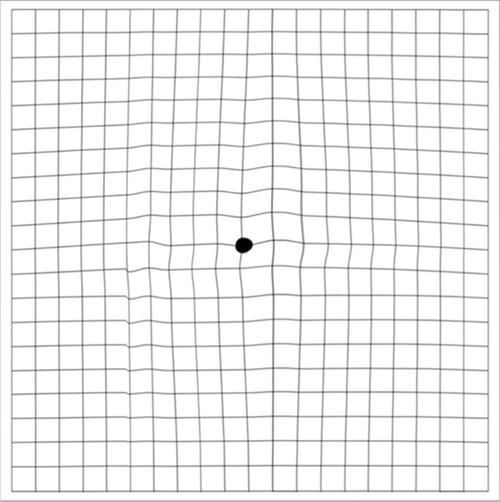 如何判斷蒙眼是否好轉(zhuǎn)，如何判斷“蒙眼是否好轉(zhuǎn)”
