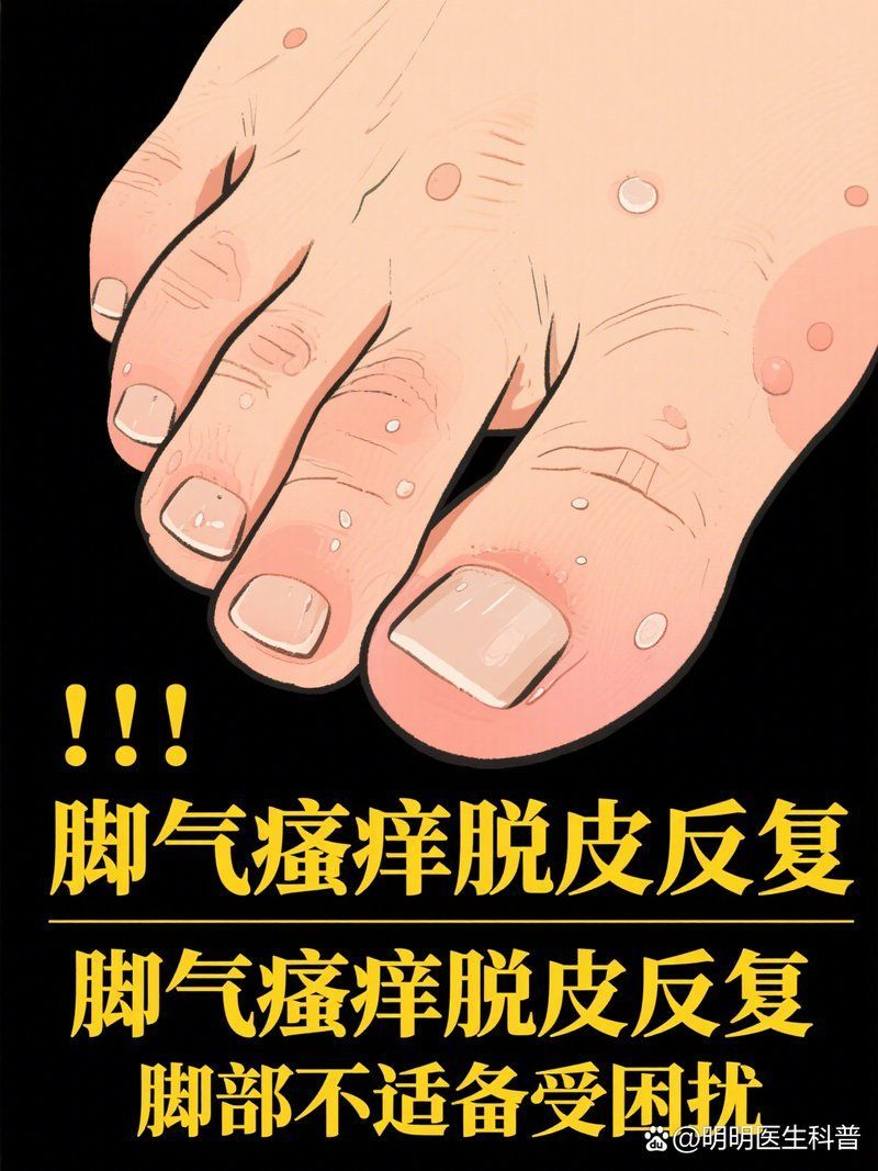 有哪些天然方法可以殺死真菌