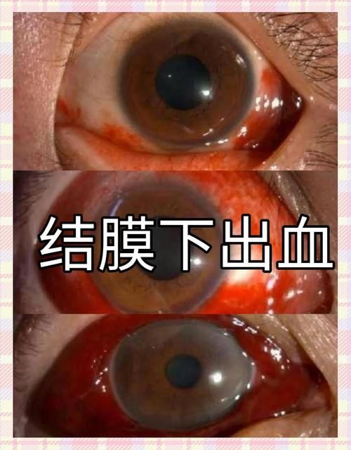 如何區分物理損傷和細菌性出血病，如何區分物理損傷與細菌性出血病