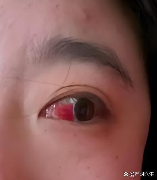 如何區分物理損傷和細菌性出血病，如何區分物理損傷與細菌性出血病