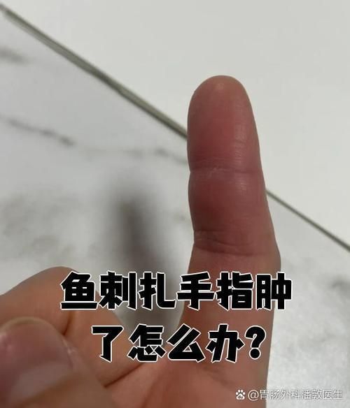 火龍魚中毒后如何急救？