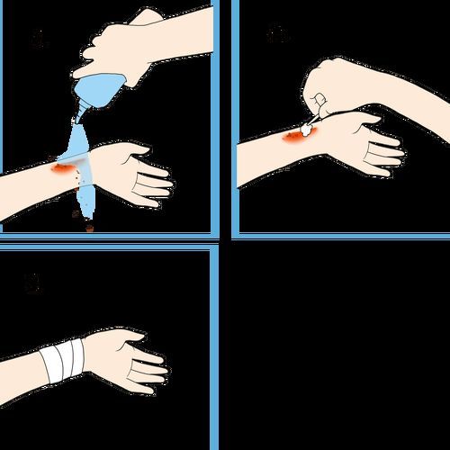 火龍魚中毒后如何急救？