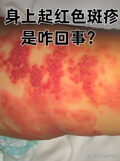 火龍魚中毒后有哪些治療方法，關于火龍魚中毒的一些建議