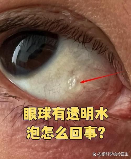 如何判斷紅龍魚眼病是否好轉？，如何判斷紅龍魚眼病好轉