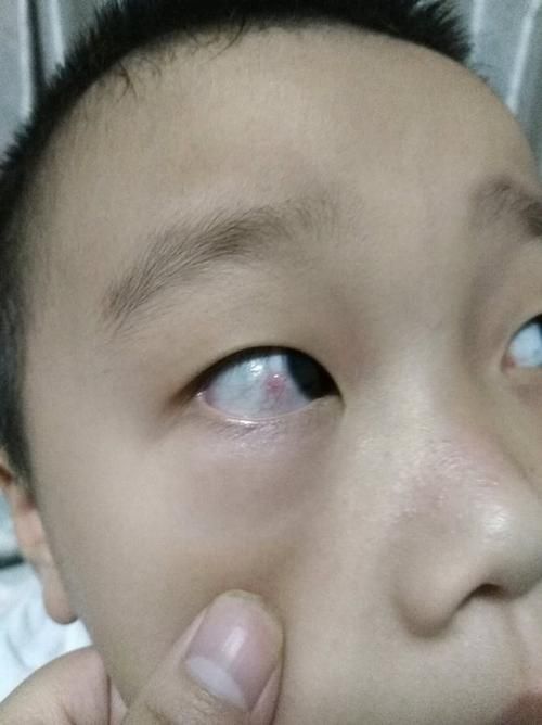 如何判斷紅龍魚眼病是否好轉？，如何判斷紅龍魚眼病好轉