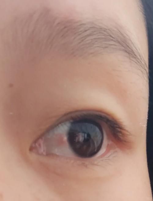 如何預防魚眼睛往外凸且發白，如何預防魚眼外凸且發白