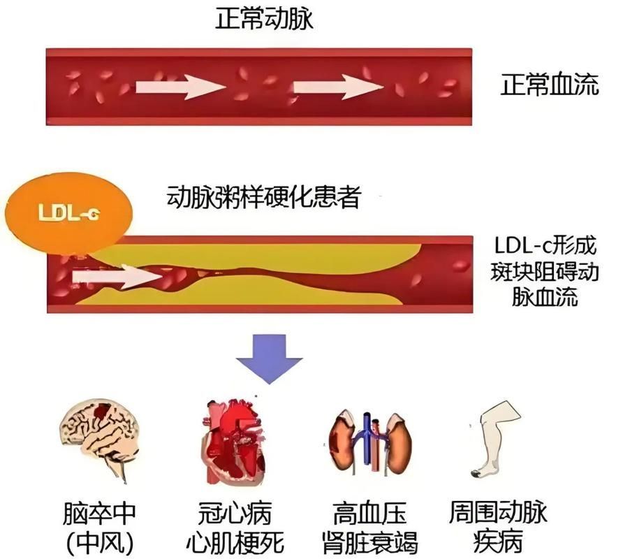 有哪些常見疾病及其防治方法，中國人群高發(fā)、具有明確防治路徑的五大類常見疾病