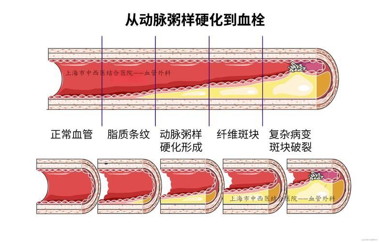 有哪些常見疾病及其防治方法，中國人群高發(fā)、具有明確防治路徑的五大類常見疾病