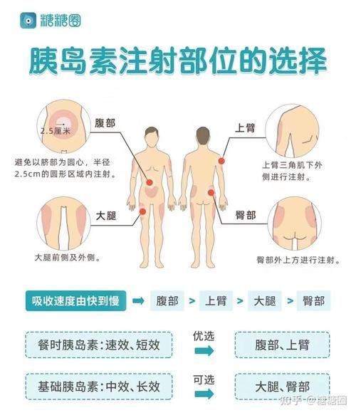 有哪些常見疾病及其防治方法，中國人群高發(fā)、具有明確防治路徑的五大類常見疾病