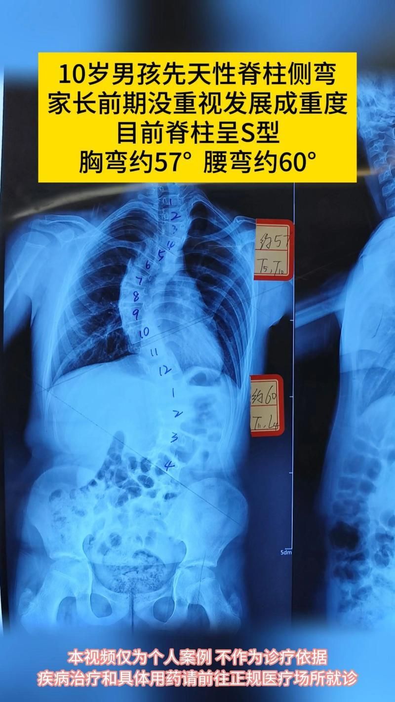 如何判斷龍魚是否營養(yǎng)缺乏？，———權威癥狀圖譜與診斷指南