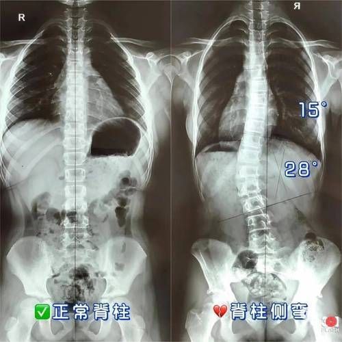 如何判斷龍魚是否營養(yǎng)缺乏？，———權威癥狀圖譜與診斷指南