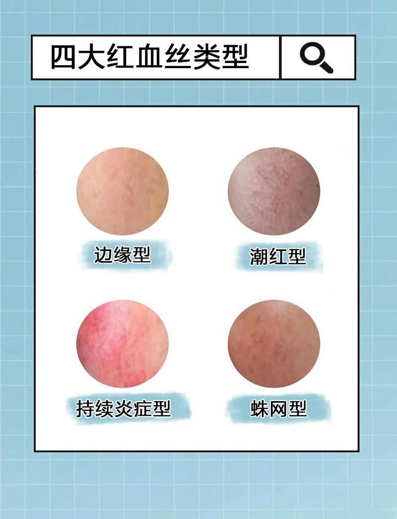 環境應激導致的充血如何判斷，環境應激導致的充血如何判斷,用戶要求詳解