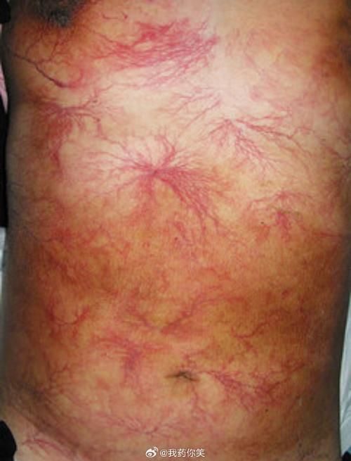 環境應激導致的充血如何判斷，環境應激導致的充血如何判斷,用戶要求詳解