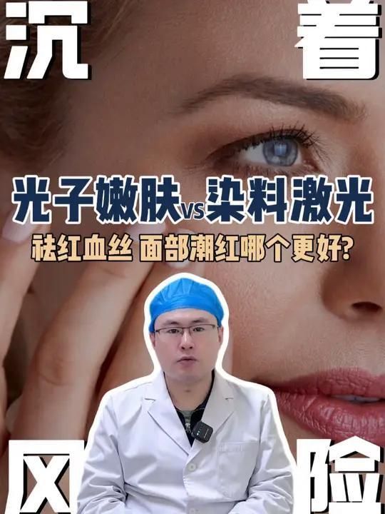 有哪些醫美方法可以去除紅血絲，祛紅血絲的方法