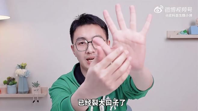 哪些人群容易患手部真菌感染，健康新知【手部真菌感染手部真菌感染的人群
