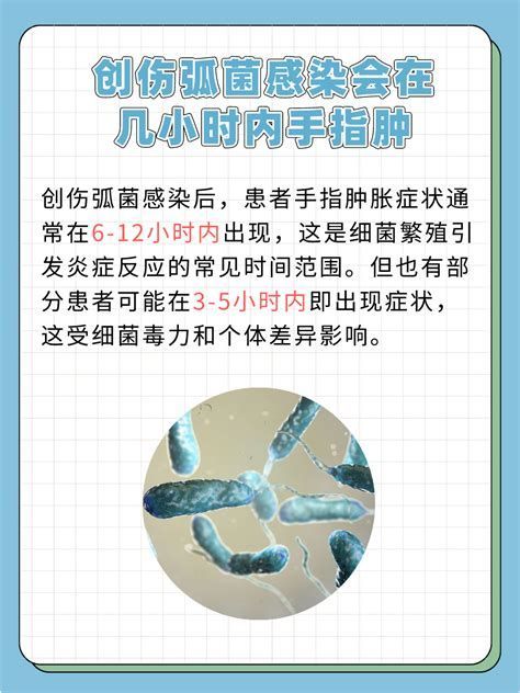海洋弧菌感染早期圖片，海洋弧菌感染初期的“偽裝術(shù)”極具欺騙性，極具挑戰(zhàn)性