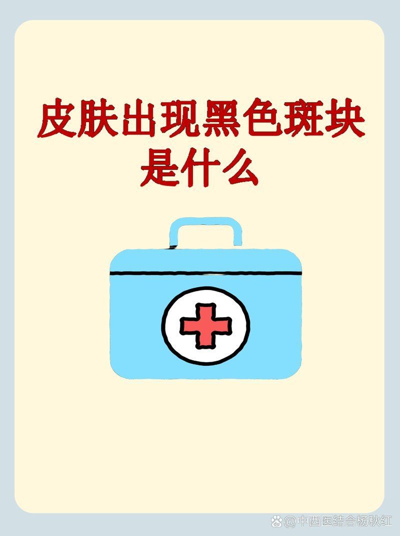 如何區(qū)分應(yīng)激性黑斑和病理性黑斑，應(yīng)激性黑斑會(huì)自行消退嗎