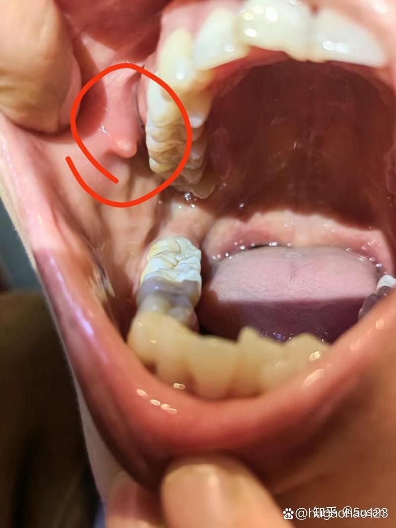 如何區分龍魚嘴邊的肉揪是腫瘤還是感染？，如何區分龍魚嘴邊的“肉揪”