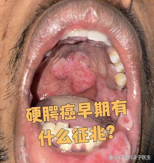如何區分龍魚嘴邊的肉揪是腫瘤還是感染？，如何區分龍魚嘴邊的“肉揪”