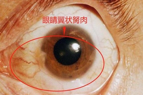 魚突眼最好治療方法