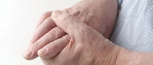 哪些真菌最容易在手上存活，———手癬日常護(hù)理清單
