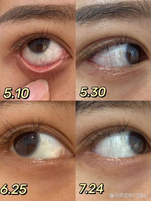 如何區分紅龍魚眼的好壞，如何區分紅龍魚的好壞