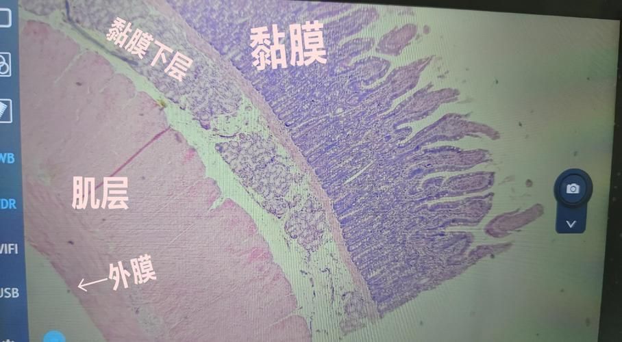 如何預防魚眼白膜的發(fā)生，如何預防魚眼白膜
