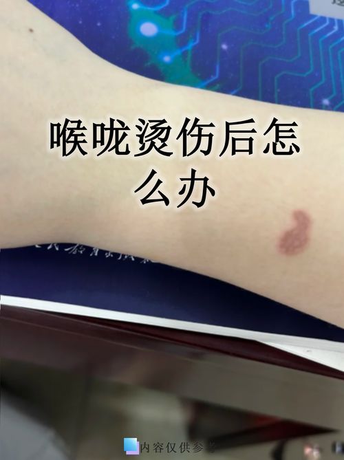 龍魚嘴撞爛后如何增強免疫力？，觀賞魚龍魚嘴部撞爛后增強免疫力需包含1000字詳解