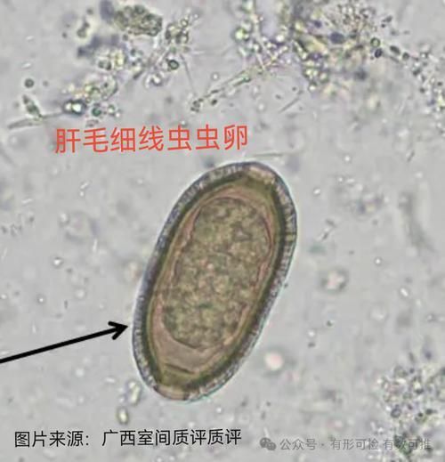 如何治療龍魚內(nèi)寄和外寄，如何呈現(xiàn)龍魚內(nèi)寄與外寄，用戶要求詳解