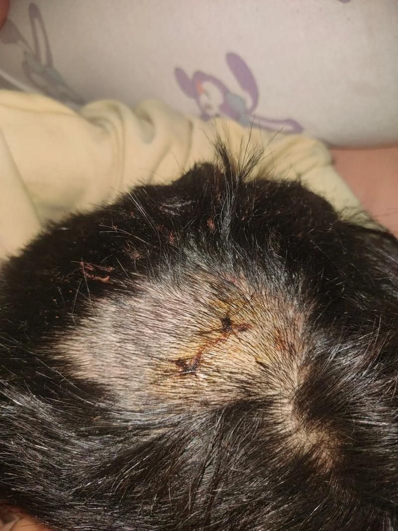 龍魚翻腮手術后如何護理，關于龍魚翻腮手術后護理