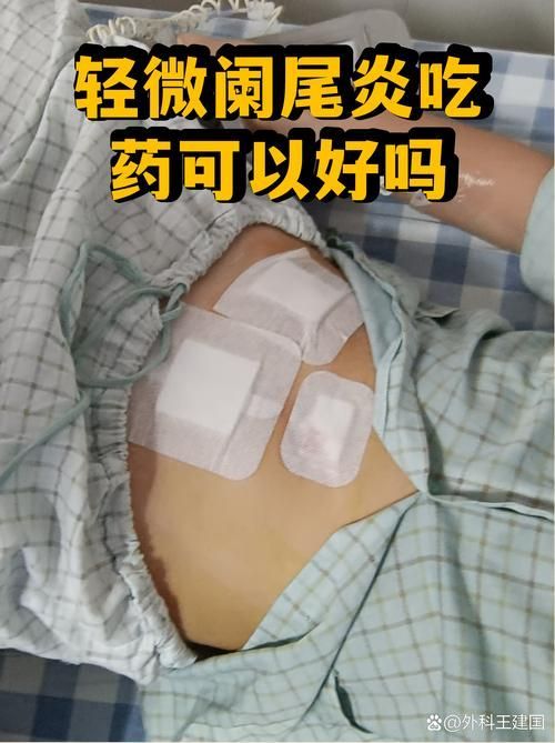 有哪些藥物可以治療爛尾，arxiv論文助手檢索+治療爛尾藥物分類詳解