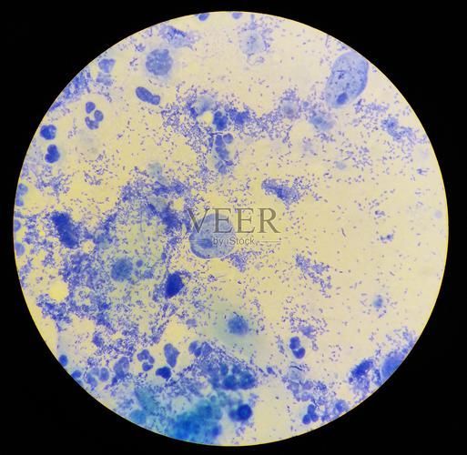 如何判斷亞甲基藍的真?zhèn)危瑏喖谆{鑒別方法