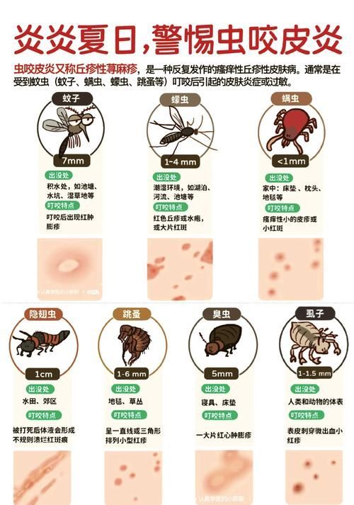 魚虱叮咬后如何護(hù)理皮膚，魚虱叮咬后如何護(hù)理皮膚,用戶要求詳解