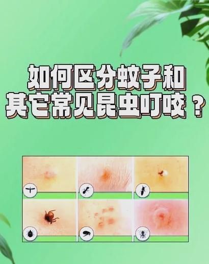 魚虱叮咬后如何護(hù)理皮膚，魚虱叮咬后如何護(hù)理皮膚,用戶要求詳解