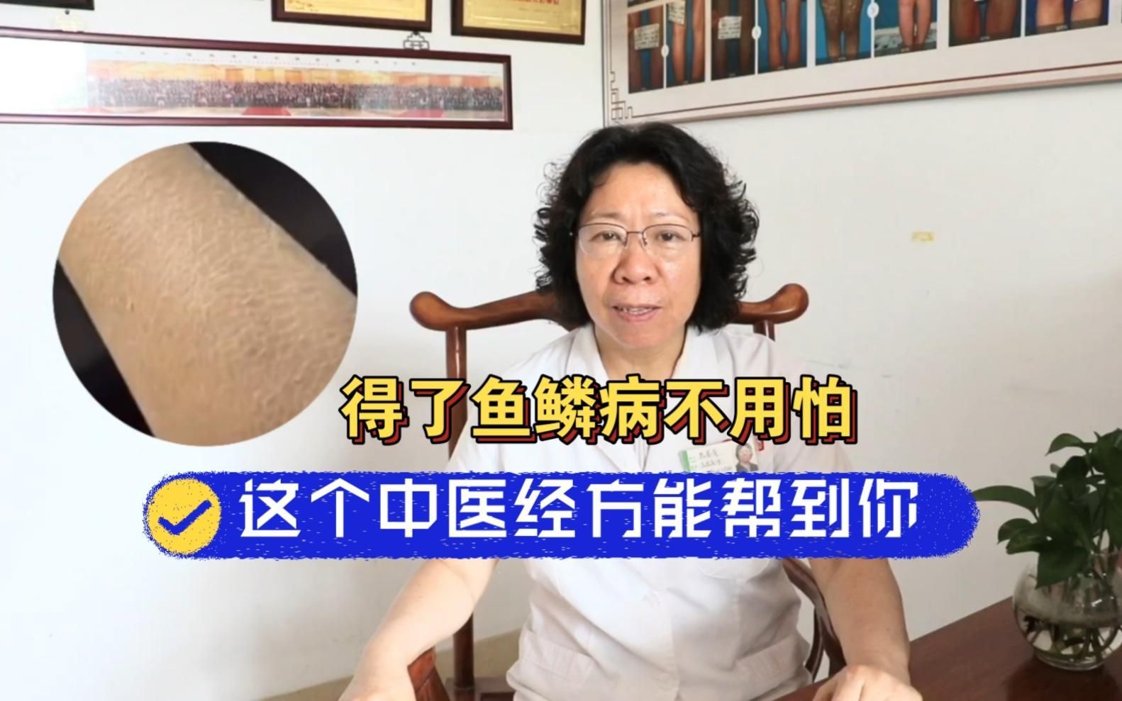 哪種醫學手段治療魚鱗紋最有效，嗶哩嗶哩，哪種醫學手段治療魚鱗紋最見效