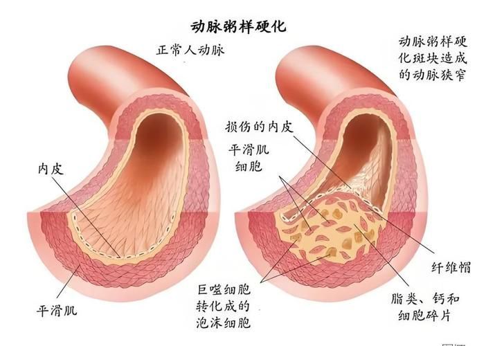 有哪些常見疾病及其防治方法，三甲醫院醫生推薦的高發疾病防治指南（*、百度健康-去問診）