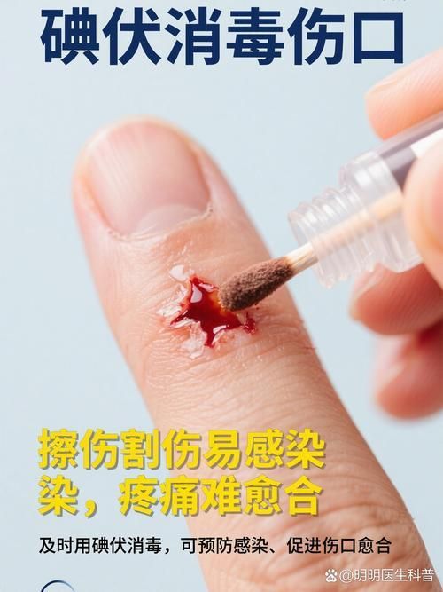 能否提供酒精和碘伏消毒的詳細步驟圖，如何正確使用酒精和碘伏消毒