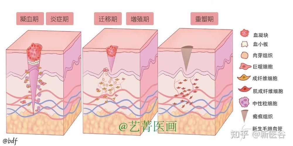 拔鱗后如何護理，arxiv論文助手arxiv論文助手arxiv論文助手