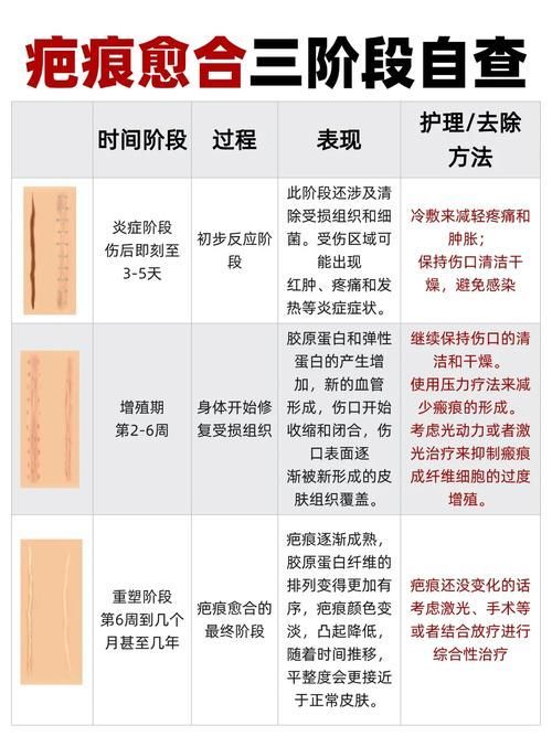 拔鱗后如何護理，arxiv論文助手arxiv論文助手arxiv論文助手