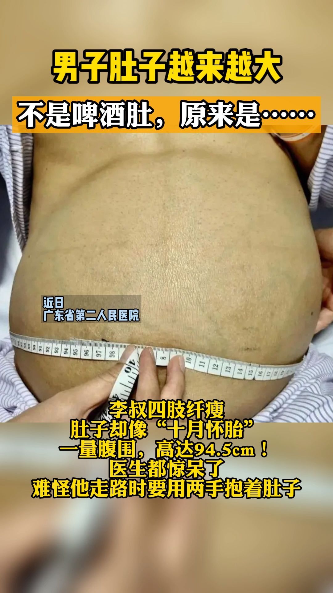 大肚子病能自愈嗎，大肚子病是怎么回事