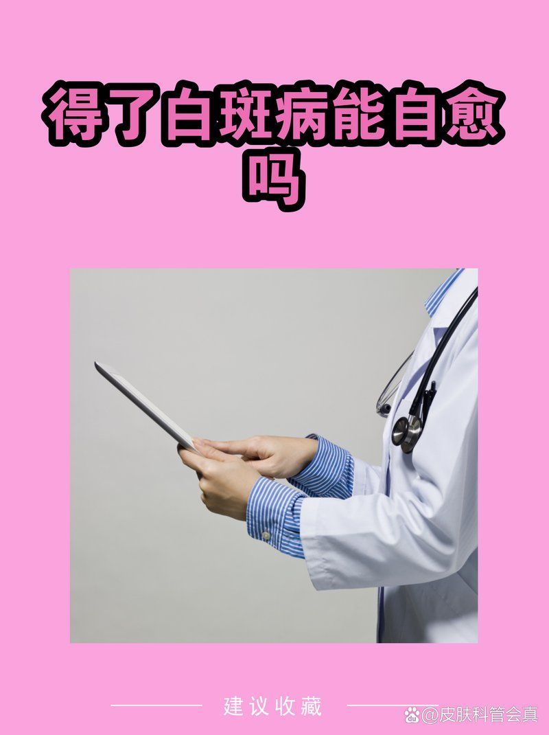 白斑病會自愈嗎，白斑病會自愈嗎白斑病自愈的可能性