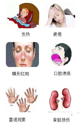 紅斑病和赤皮病有何區別，紅斑病與赤皮病的區別