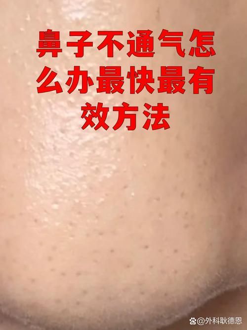 如何判斷虎魚突眼的嚴重程度，如何判斷虎魚突眼嚴重程度