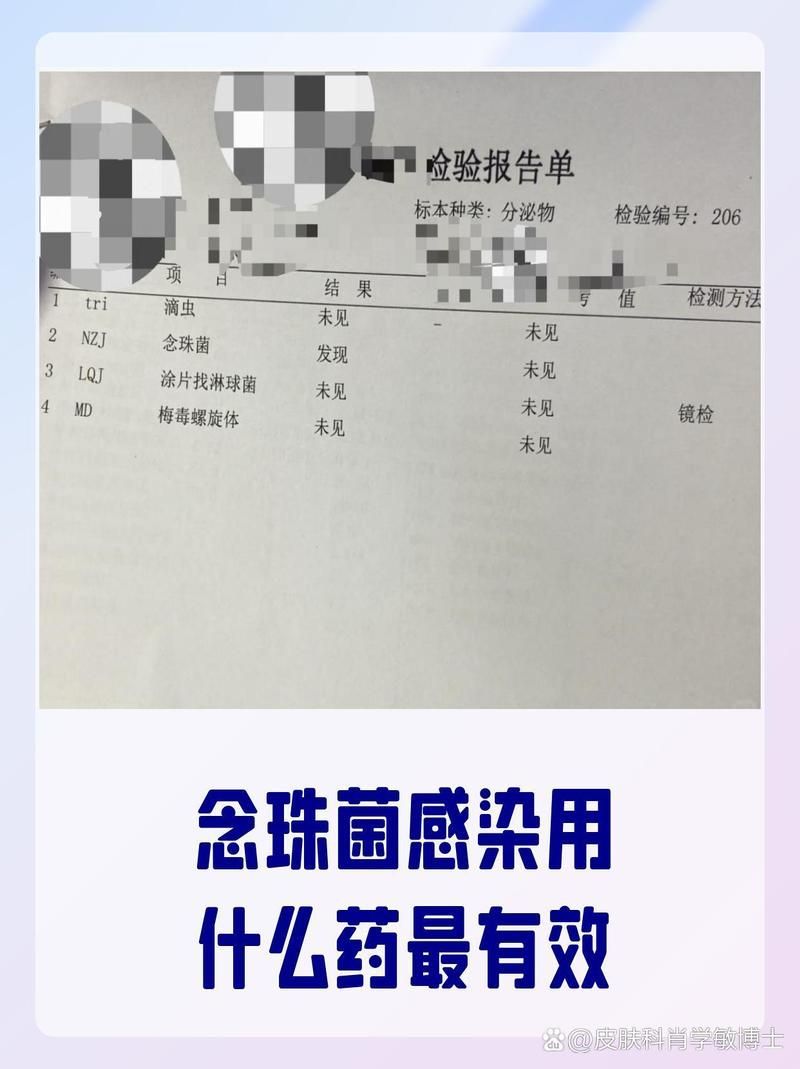 有哪些藥物可以有效治療念珠菌感染，哪些藥物可以有效治療念珠菌感染