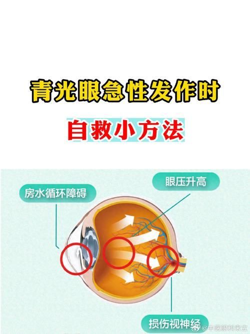 氣蒙眼如何急救，“氣蒙眼”如何急救